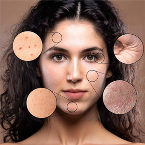 How collagen supplements helps in replacing dead skin cells